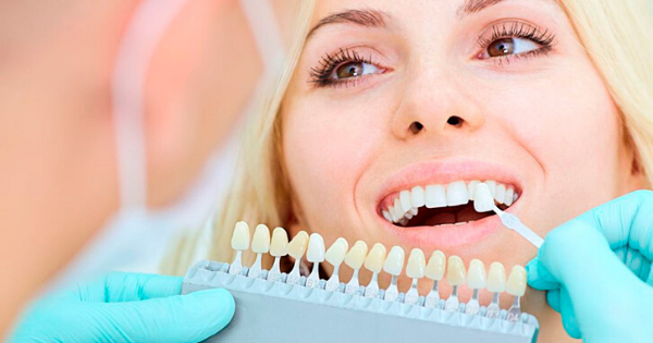 Faccette Dentali O Estetica Dentale E Adesiva - Studio Dentistico - Foto 3