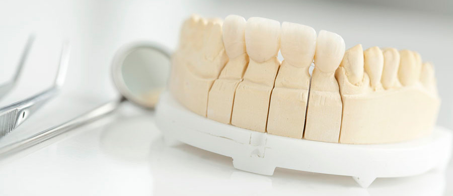 Una corona dentale artificiale è una protesi fissa che riveste esternamente il nostro dente. Con il turismo dentale in Moldavia, puoi beneficiare dell'installazione della corona artificiale realizzata con materiali di altissima qualità nella clinica dentale Grand Turismo Dentale