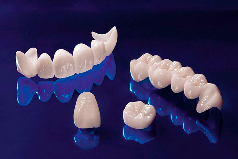 La protesi dentale é un sostituto dentale mobile che sostituisce i denti mancanti.