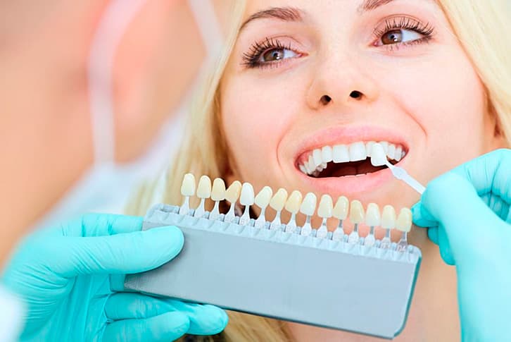 Vantaggi delle faccette dalla clinica clinica Grand Turismo Dentale in Moldavia-  i denti più bianchi e regolari; allineamento di denti erosi; lucidità dello smalto; correzioni della spaziatura tra un dente e l’altro.