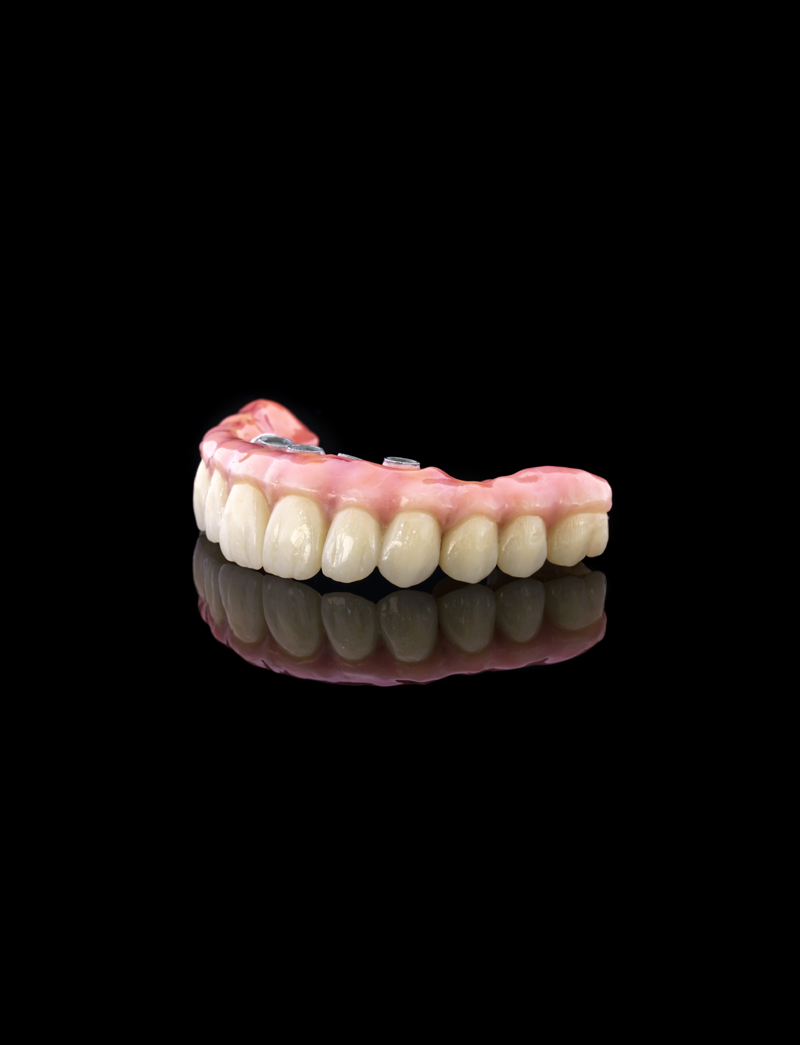 Offerta Impianto All on 4 con il prezzo di 1 960 € include i seguenti lavori e materiali: 4 impianti dentali; 4 abutments; 12 denti provvisori (mobili); 12 corone in resina (denti fissi)